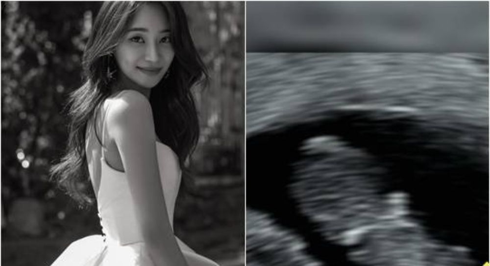 Former AOA member Yuna reveals she’s expecting her first baby in sweet message